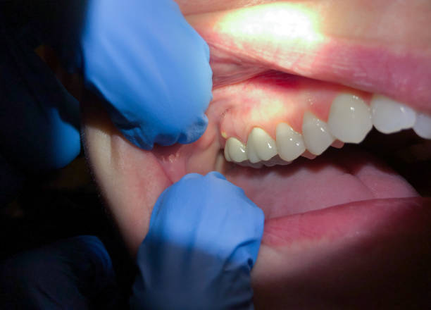 Best Weekend Emergency Dentist in Orchard Grass Hills, KY